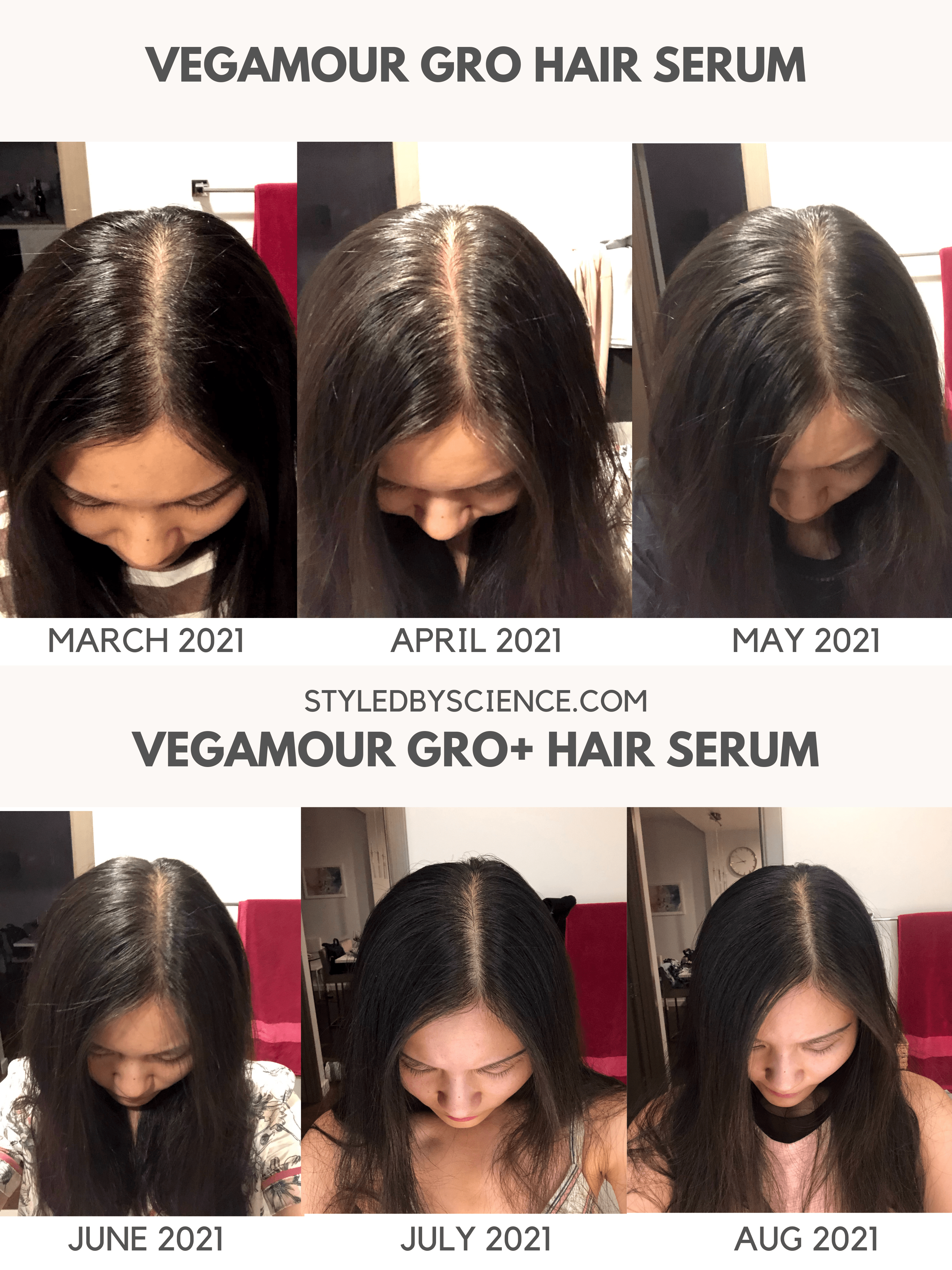 Does Vegamour Gro Serum Really Work - Sidney Mears